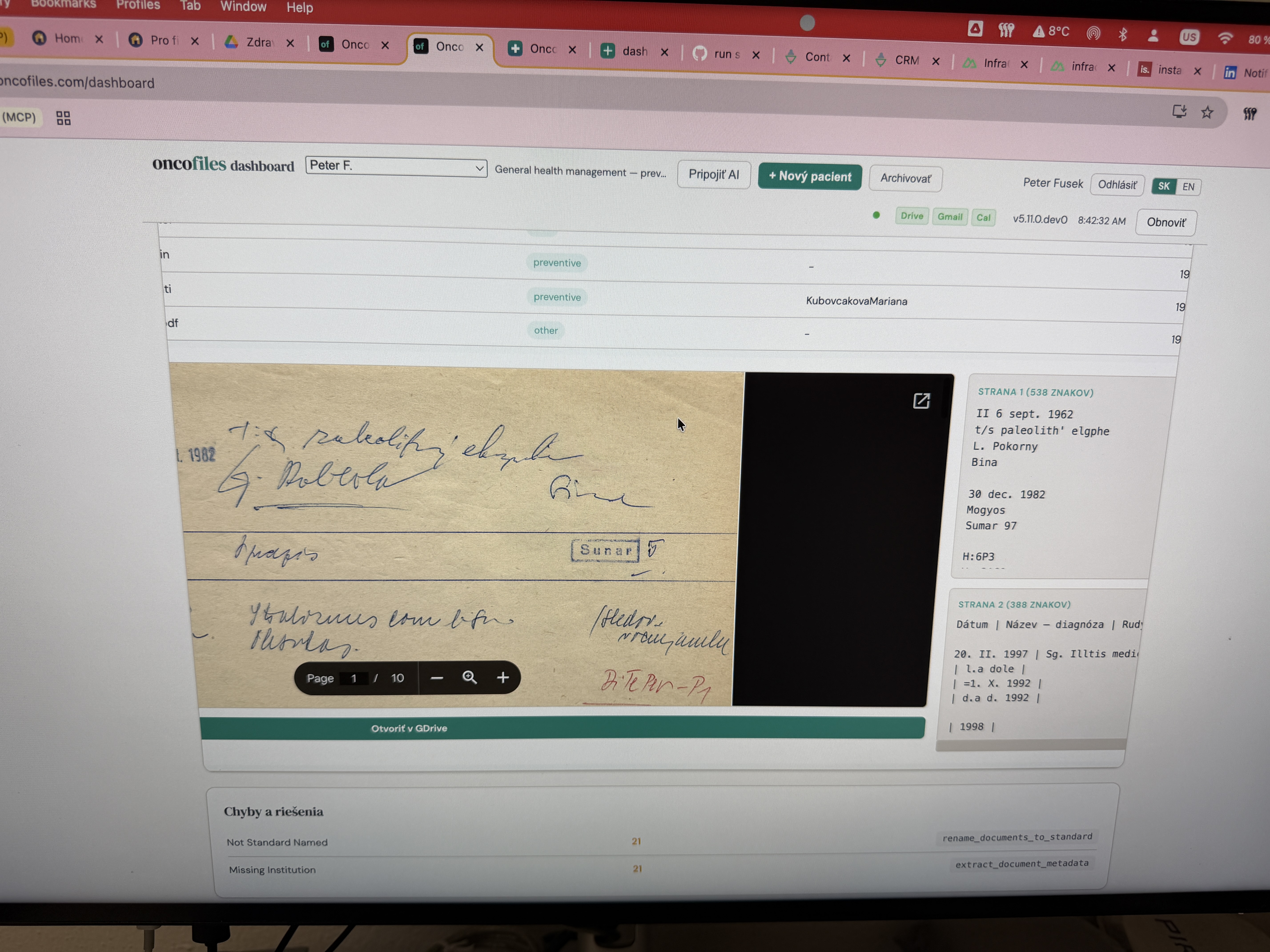 Oncoteam dashboard rendering a 1982 Slovak handwritten doctor's note, with the OCR-extracted structured text alongside the scanned page.